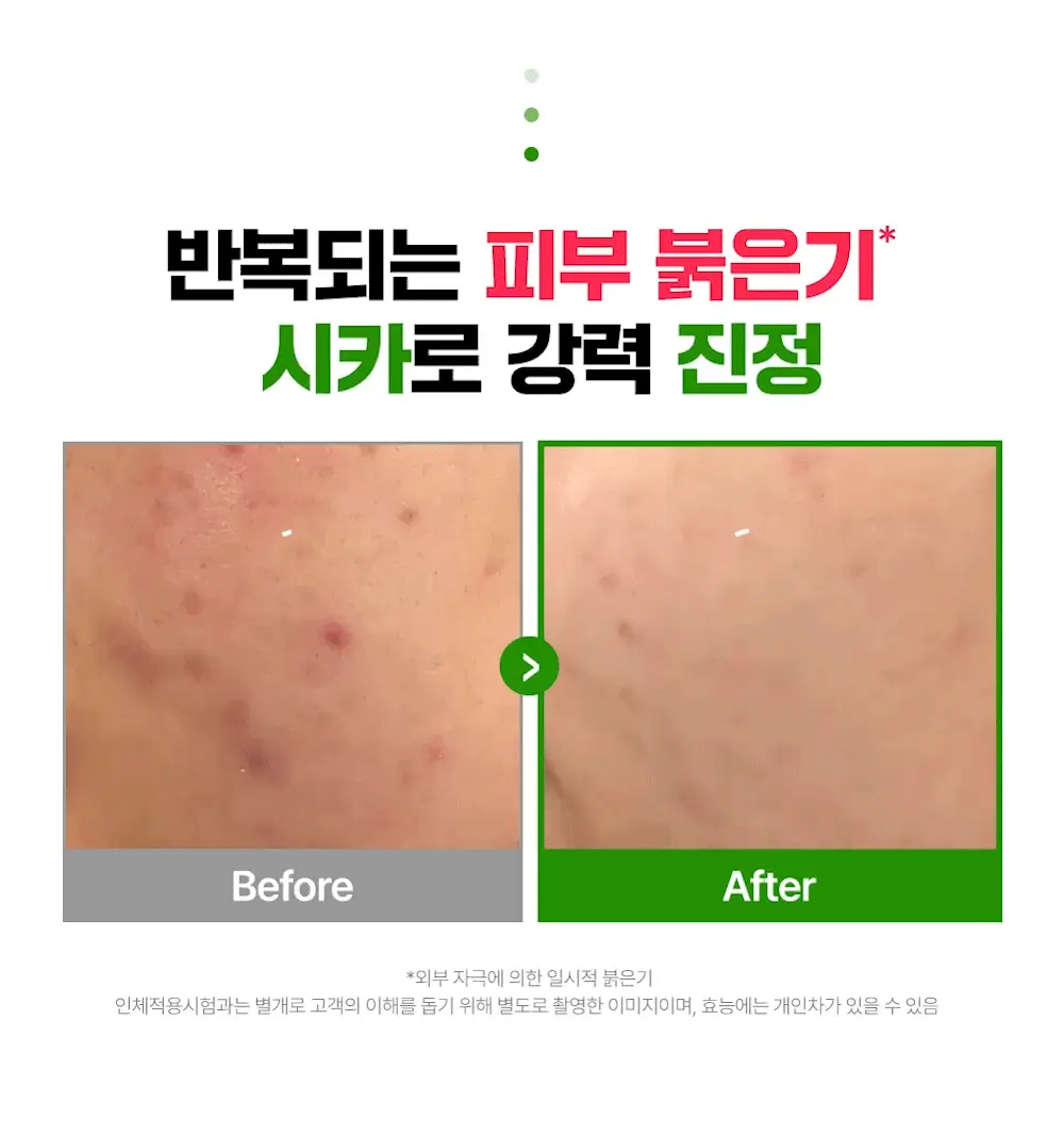 [진정크림/총100ml] 웰라쥬 리얼 시카카밍 95 크림 80ml 기획 (+20ml) 상세페이지 6